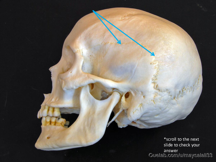 Bone Practice Exam