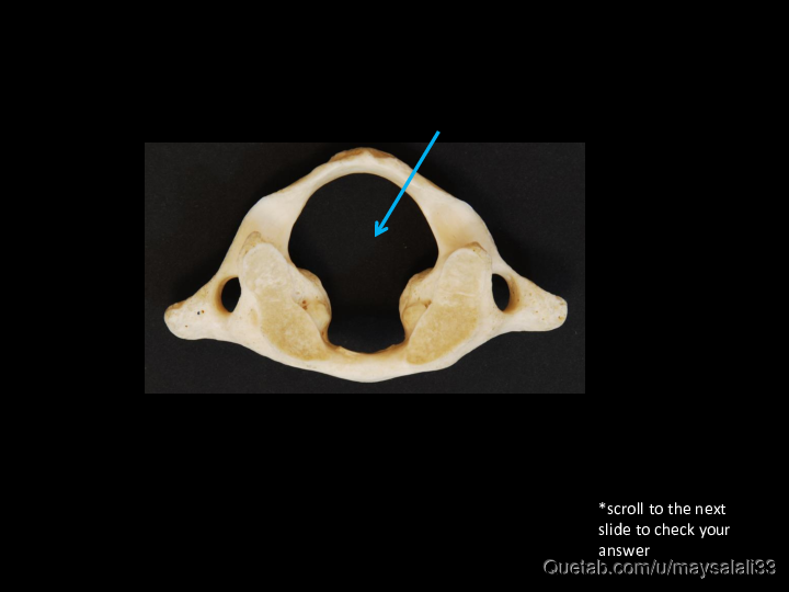 Bone Practice Exam