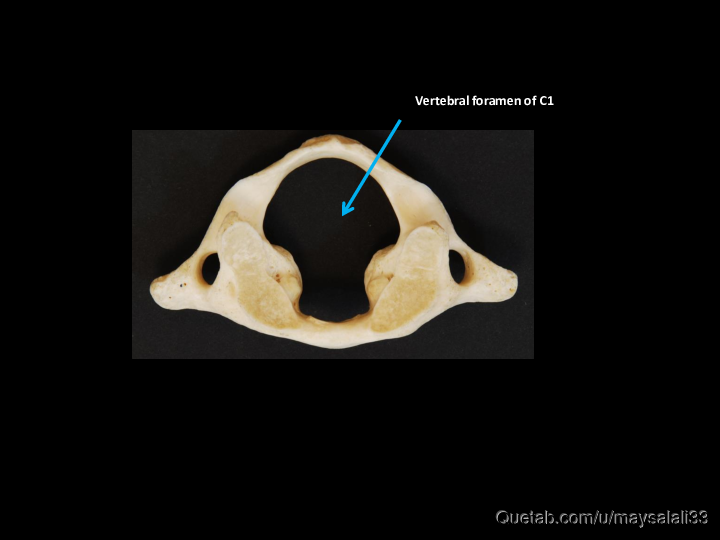 Bone Practice Exam