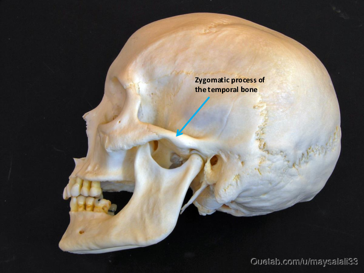 Bone Practice Exam