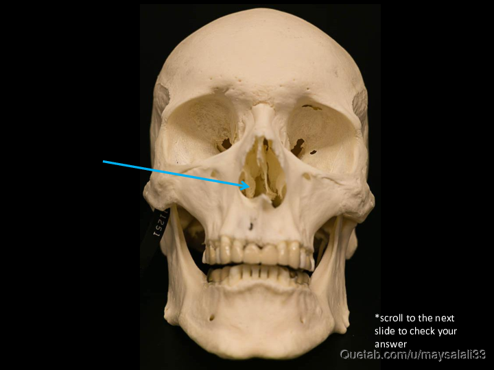 Bone Practice Exam