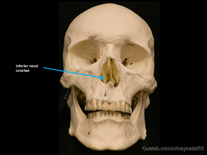 Bone Practice Exam