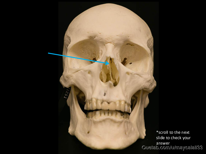 Bone Practice Exam