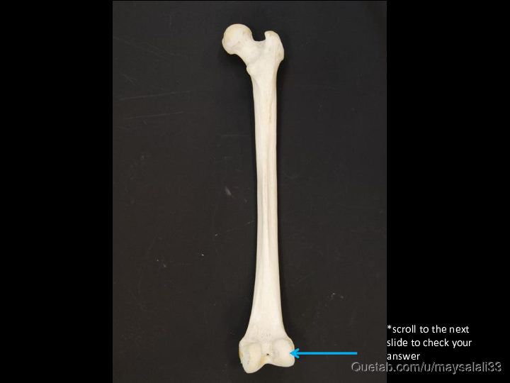 Bone Practice Exam