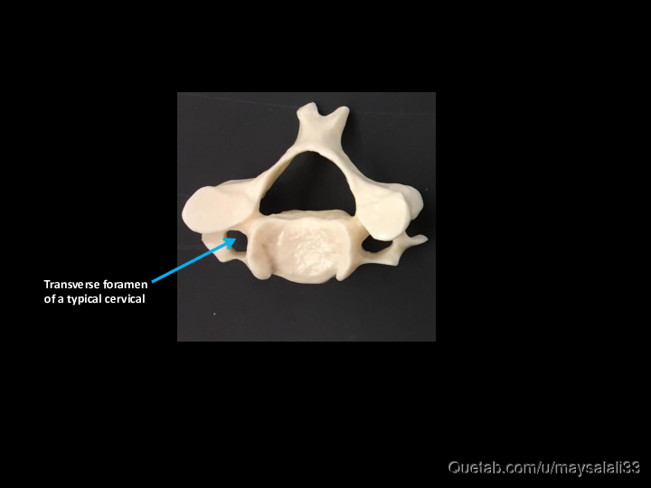 Bone Practice Exam