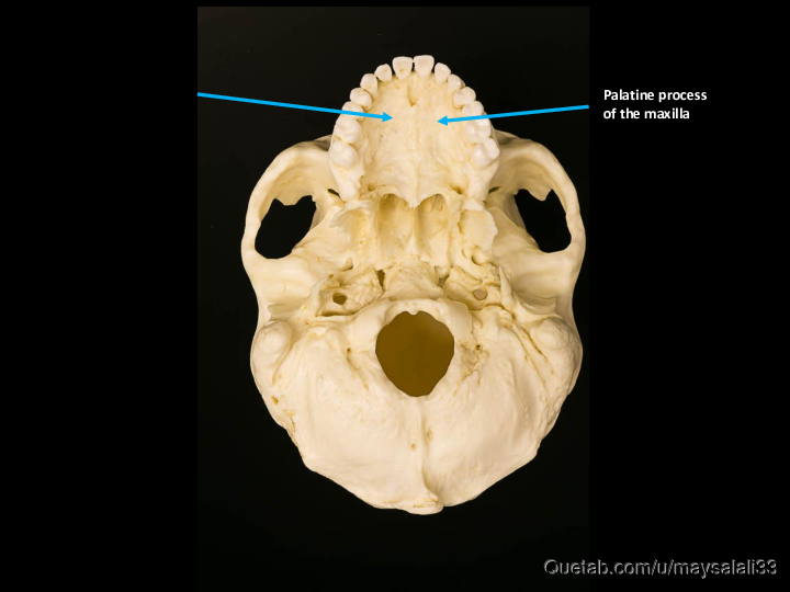 Bone Practice Exam