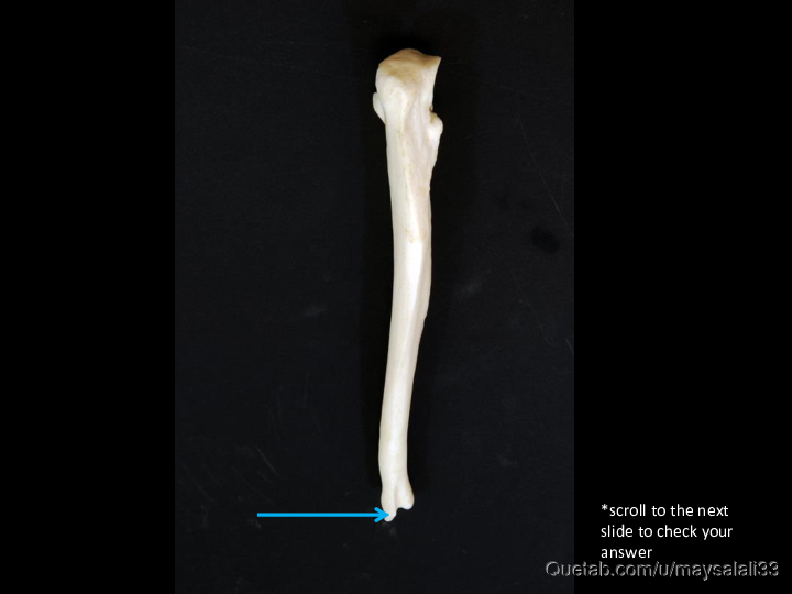 Bone Practice Exam