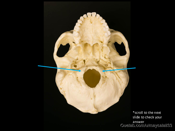 Bone Practice Exam