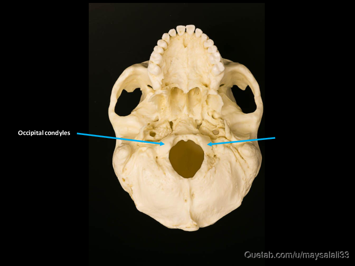 Bone Practice Exam