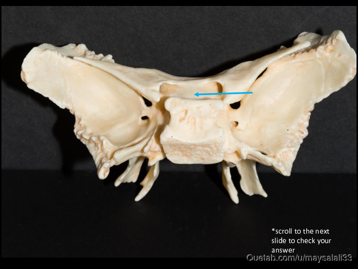 Bone Practice Exam