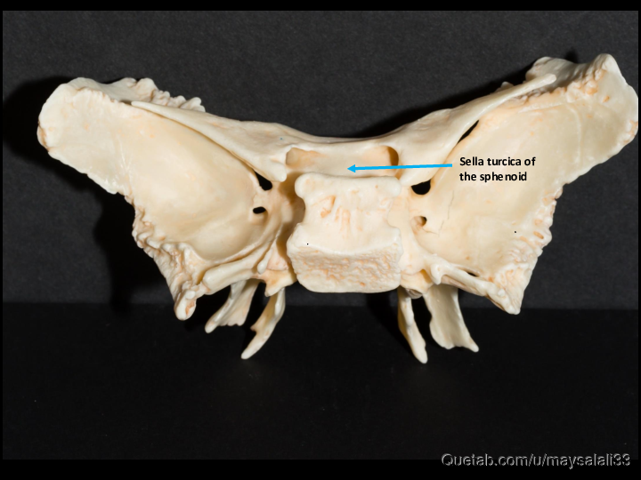 Bone Practice Exam