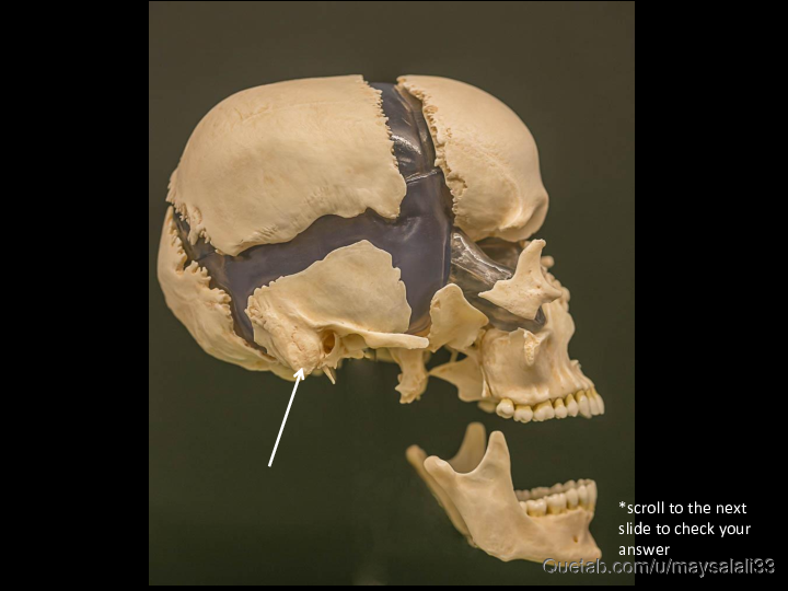 Bone Practice Exam