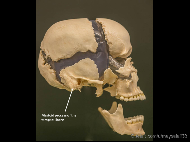 Bone Practice Exam