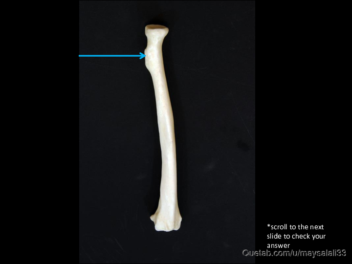 Bone Practice Exam