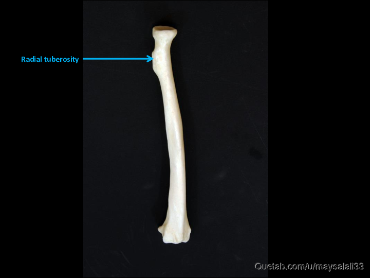 Bone Practice Exam