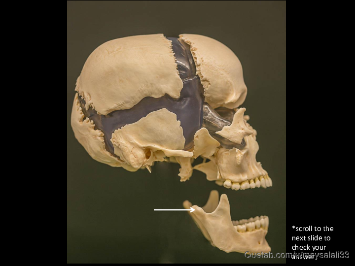 Bone Practice Exam