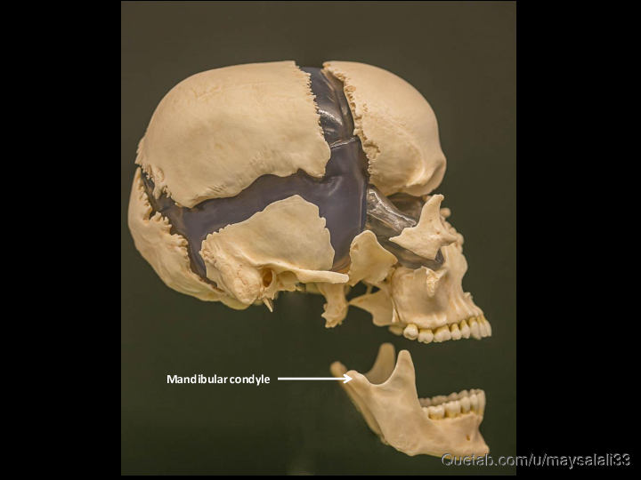 Bone Practice Exam