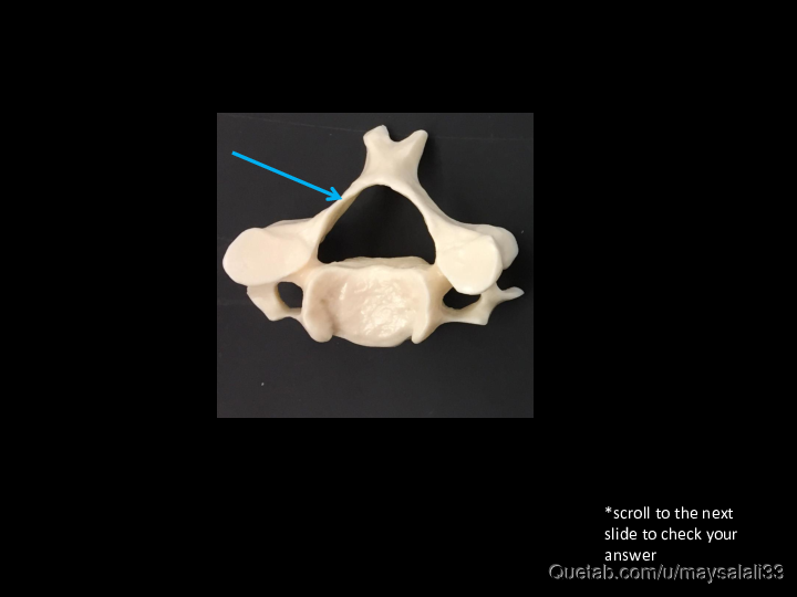 Bone Practice Exam