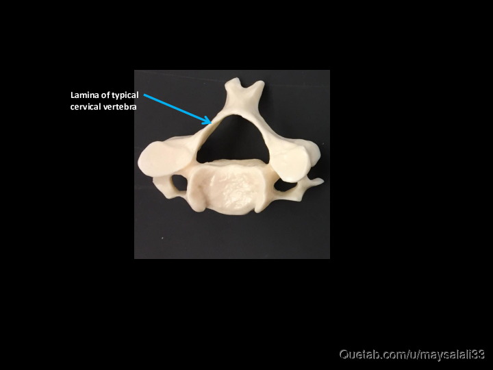 Bone Practice Exam