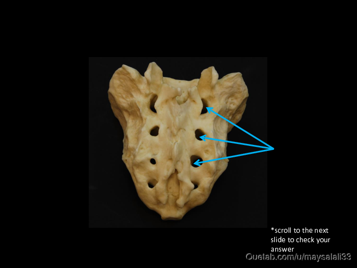 Bone Practice Exam