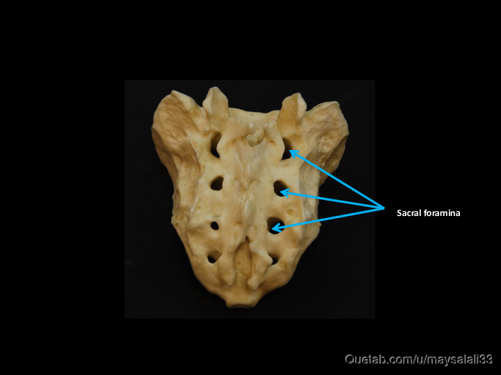 Bone Practice Exam