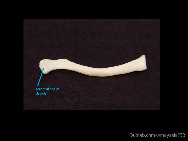 Bone Practice Exam