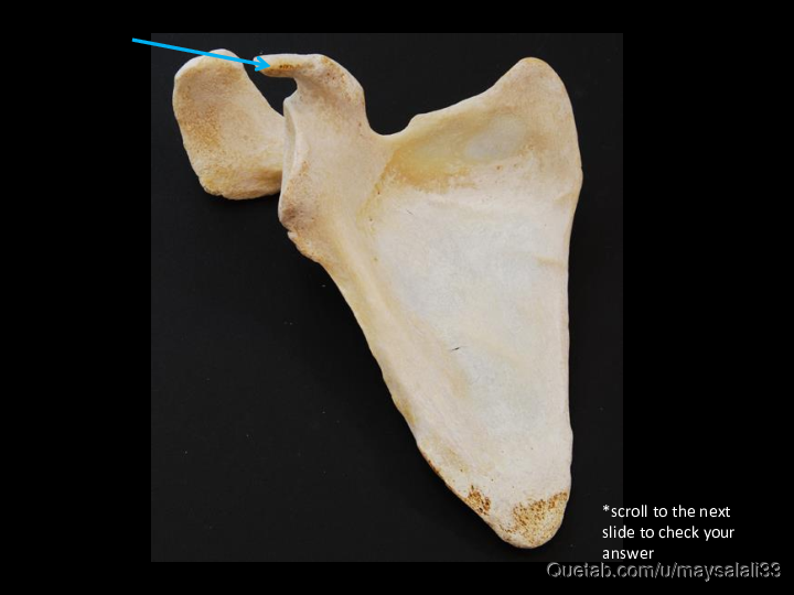 Bone Practice Exam