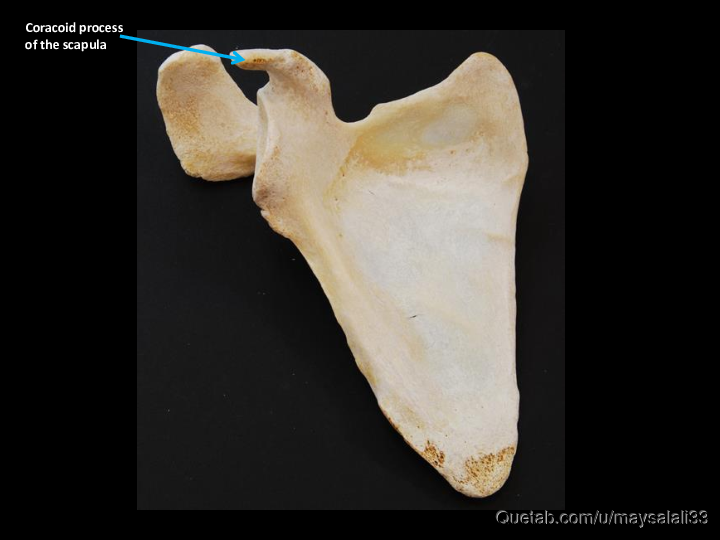 Bone Practice Exam