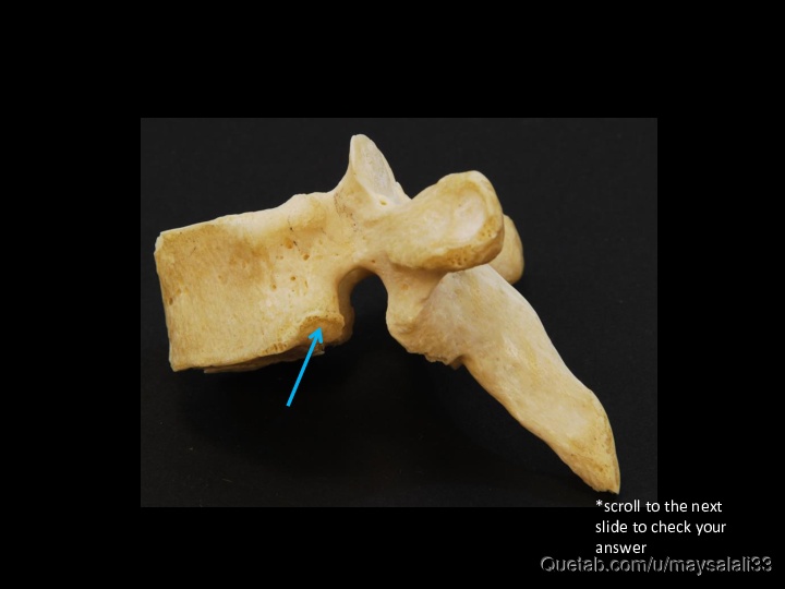 Bone Practice Exam