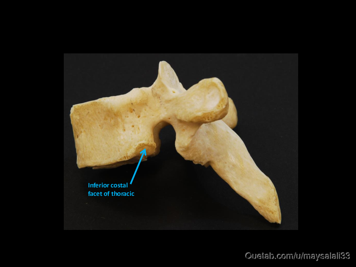 Bone Practice Exam