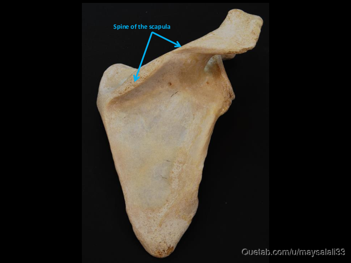 Bone Practice Exam