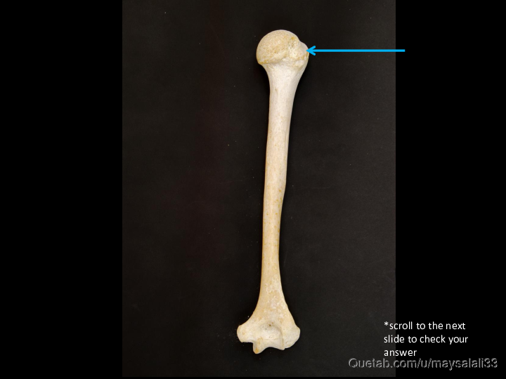 Bone Practice Exam