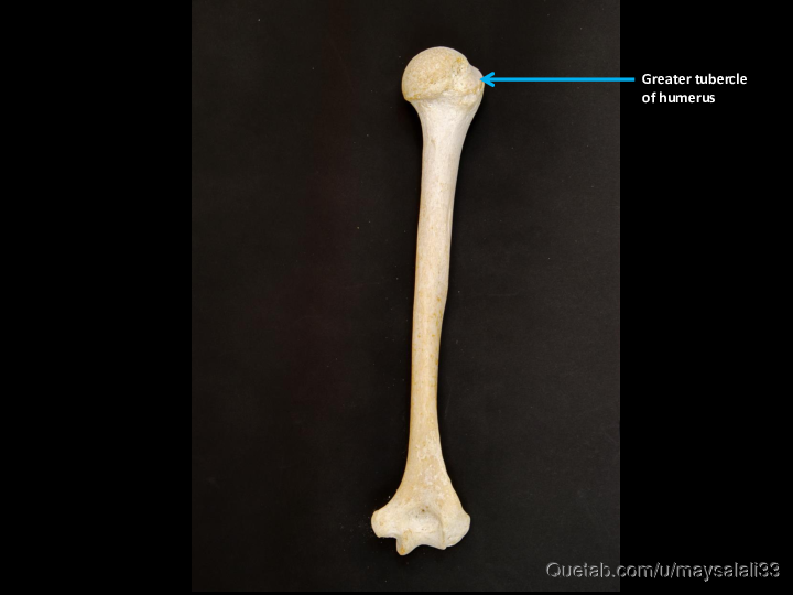 Bone Practice Exam