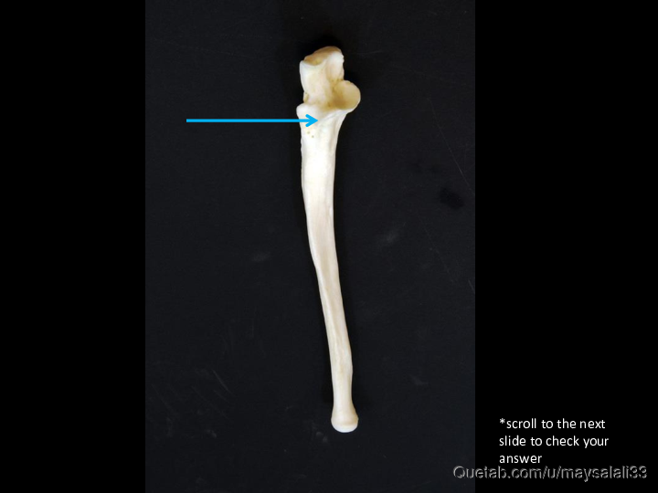 Bone Practice Exam