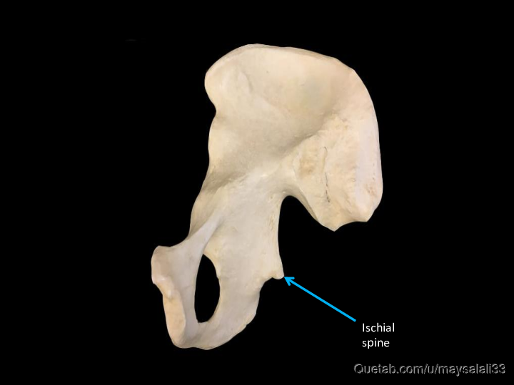 Bone Practice Exam