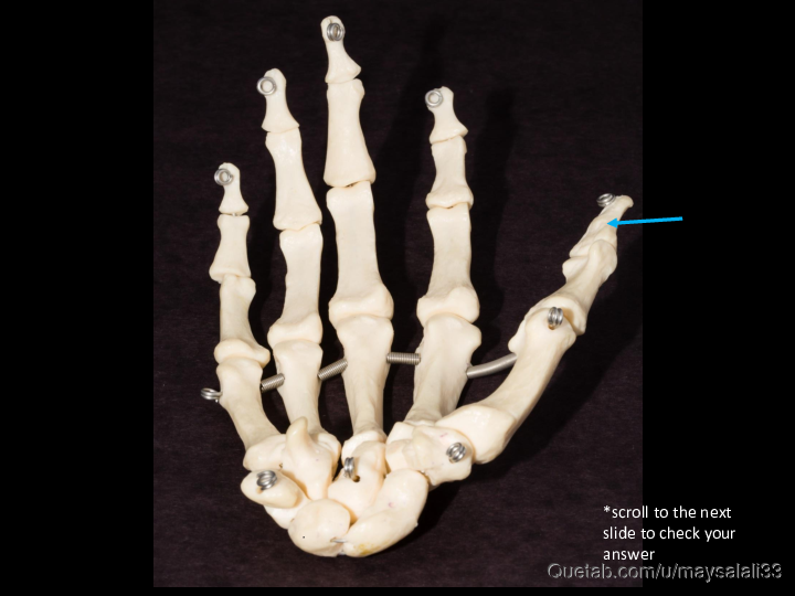 Bone Practice Exam