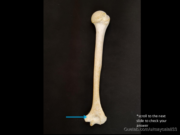 Bone Practice Exam