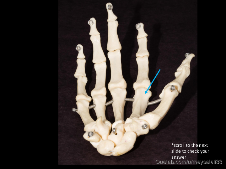 Bone Practice Exam