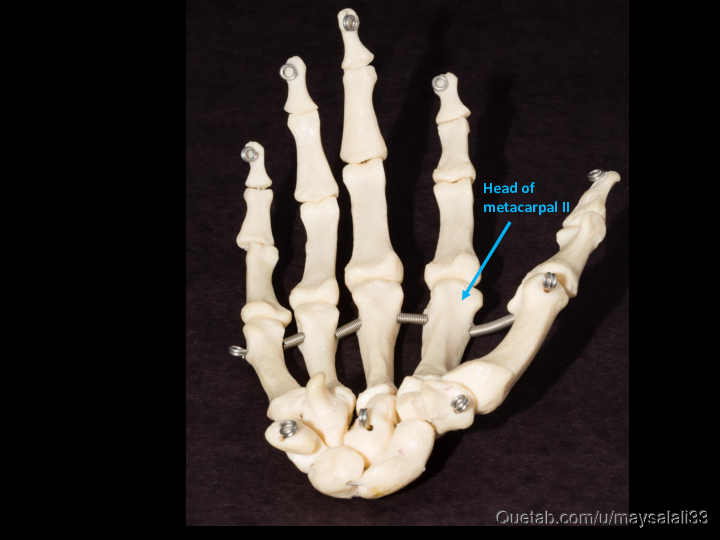 Bone Practice Exam