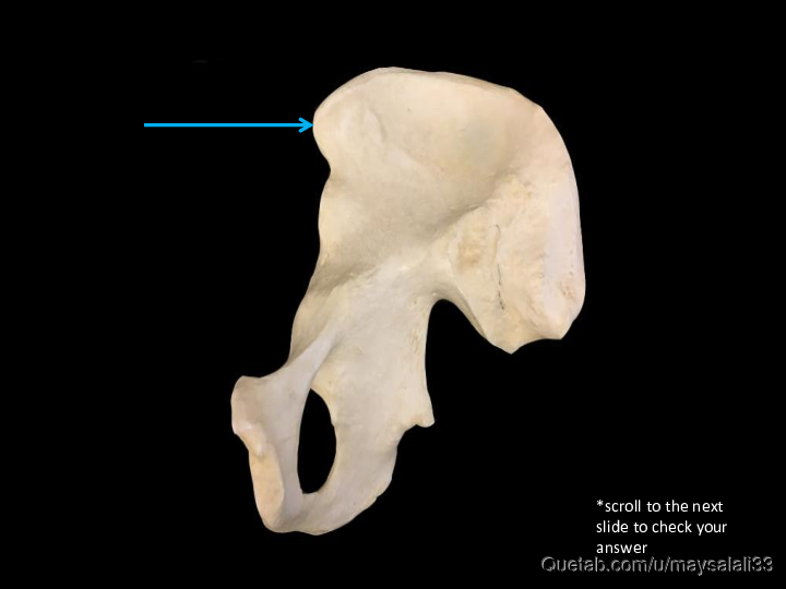 Bone Practice Exam