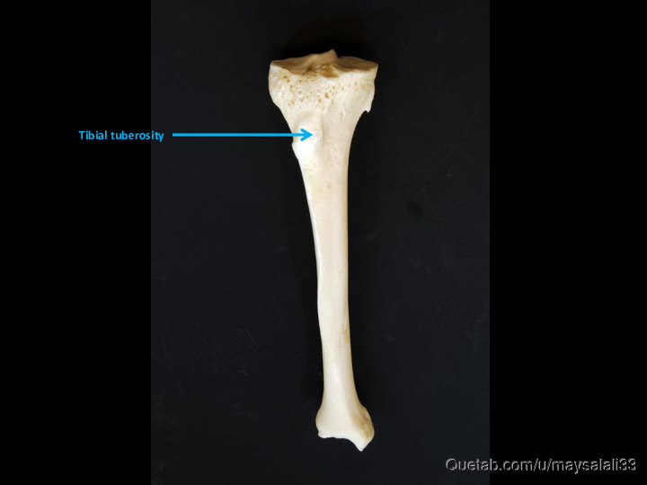 Bone Practice Exam