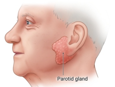 Parotid glands are located in front of the ears
